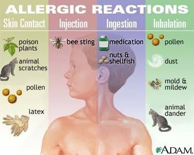 Αλλεργίες