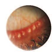 Oct; 0(5):505-50.. Acta Parasitol.