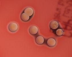 Ο Staphylococcus aureus ή αλλιώς χρυσίζων σταφυλόκοκκος είναι αναερόβιο Gramθετικό βακτήριο, στρογγυλού σχήματος, το οποίο είναι μέλος της οικογένειας Firmicutes και αποτελεί το συχνότερο αίτιο των
