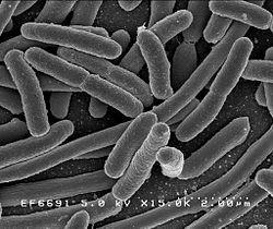 Η Escherichia coli είναι ένα αρνητικό Gram, ραβδοειδούς σχήματος κολοβακτηρίδιο. Συνήθως βρίσκεται στο έντερο ενδόθερμων ζώων.