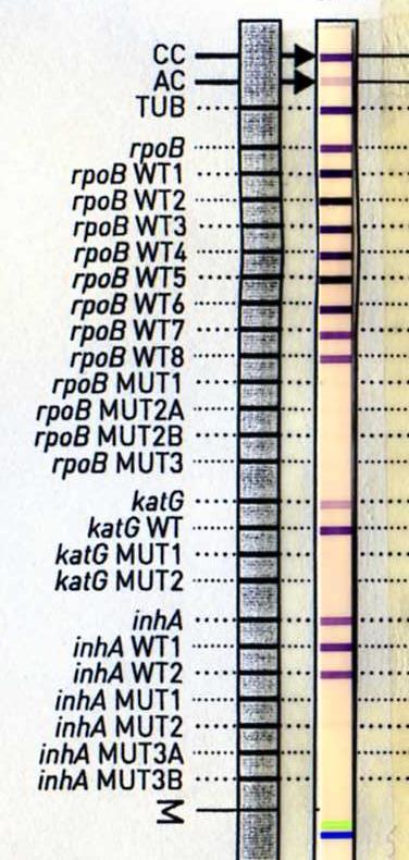 GenoType MTBDRplus kit