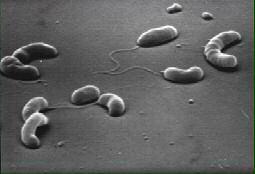 Σχήμα 10: Μικρόβιο της Χολέρας (Vibrio Cholerae) Σε αντίθεση με άλλες μορφές θαλάσσιας ρύπανσης, όπως τις πετρελαιοκηλίδες, όπου βελτιωτική δράση μπορεί να αναληφθεί μετά το ατύχημα, από την οποία το