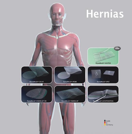 Hernias ΣΥΣΚΕΥΗ ΓΙΑ