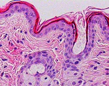 B Epidermal thickness (µm) 25 2 15 1 5 VEH/VEH
