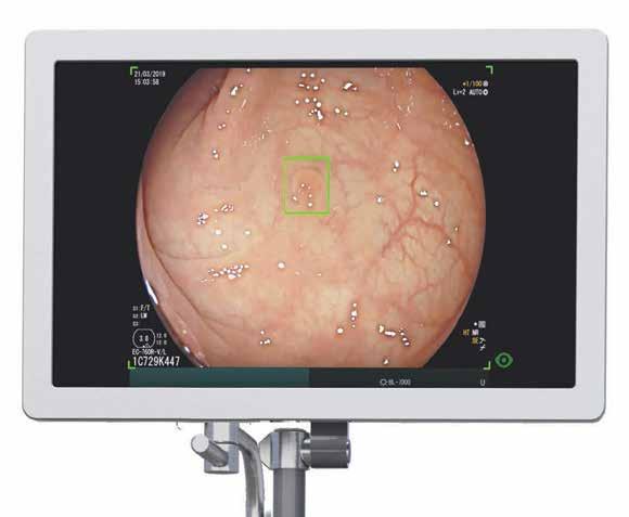 Corley DA, Jenson CD, Marks AR JR, et al. Adenoma Detection Rate and Risk of Colorectal Cancer and Death. NEJM 04;370:98-306.