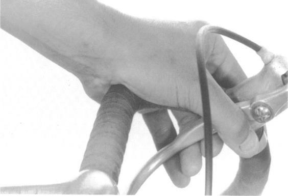 ΑΡ - Πιο βολική χρήση ΔΕ I J Braithwaite, Bilateral median nerve palsy in a cyclist, 1992 Mar;26(1):27-8.