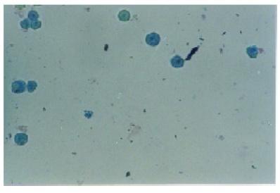 Εικόνα 12. Μικροςκοπική παρατήρηςη κυττάρων μετά τη χρϊςη με trypan blue. [Goran N. Kaluđerovid et al.