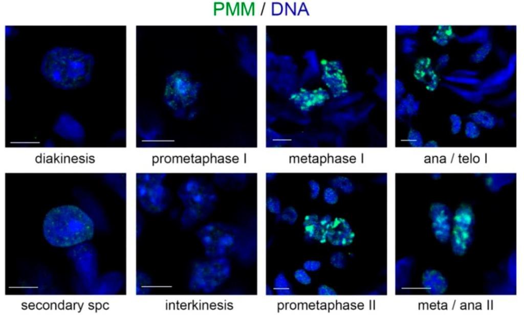 ~ 87 ~ Εικόνα 53. Πρότυπο κατανομής της τριπλής τροποποίησης PMM σε μειωτικά σπερματοκύτταρα. Α. Το μοτίβο ΡΜΜ εντοπίζεται σε σπερματοκύτταρα κατά την πρώτη αλλά και τη δεύτερη μειωτική διαίρεση.