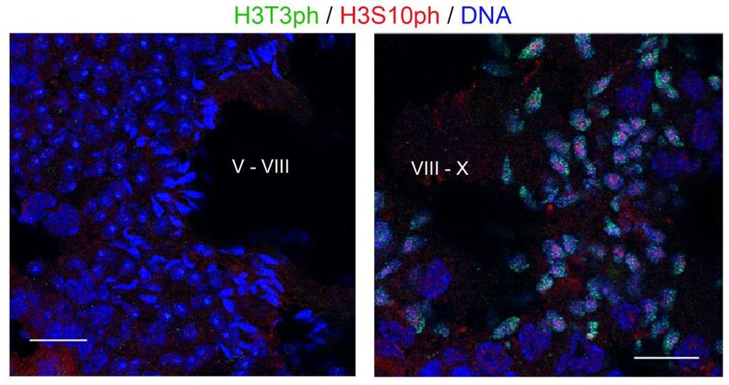 ~ 100 ~ Εικόνα 66. Σχετική κατανομή των H3Τ3ph και H3S10ph σε σπερματοφόρα σωληνάρια σταδίων VI-VIII (αριστερά) και VIII-X (δεξιά), μετά από διπλό ανοσοφθορισμό. Η χρώση του DNA έγινε με TO-PRO 3.