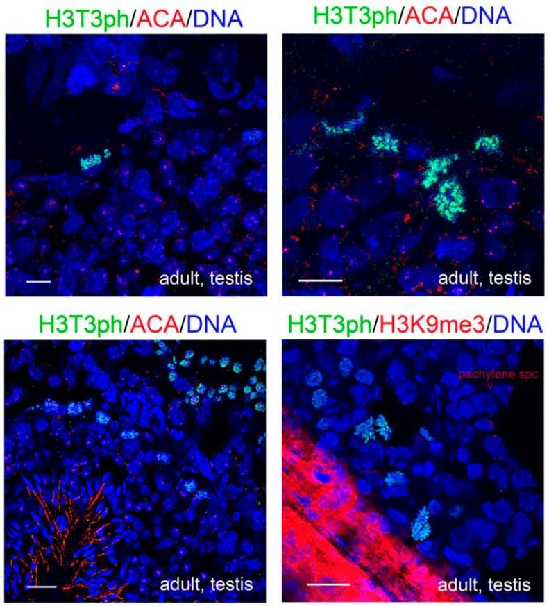 ~ 82 ~ Εικόνα 48. Ο εντοπισμός της H3T3ph σε σπερματογόνια ενήλικου ποντικού. Έμμεσος ανοσοφθορισμός με αντισώματα έναντι της Η3Τ3ph και της Crest (ACA).