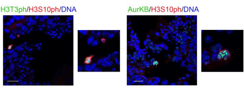 Η ταυτόχρονη χρώση τομών κρυοστάτη με τα ah3t3ph και a H3K9me3 υπέδειξε ότι τα διαιρούμενα σπερματογόνια που έχουν H3T3ph είναι εμφανώς διαχωρισμένα από τα προφασικά σπερματοκύτταρα (μειωτική