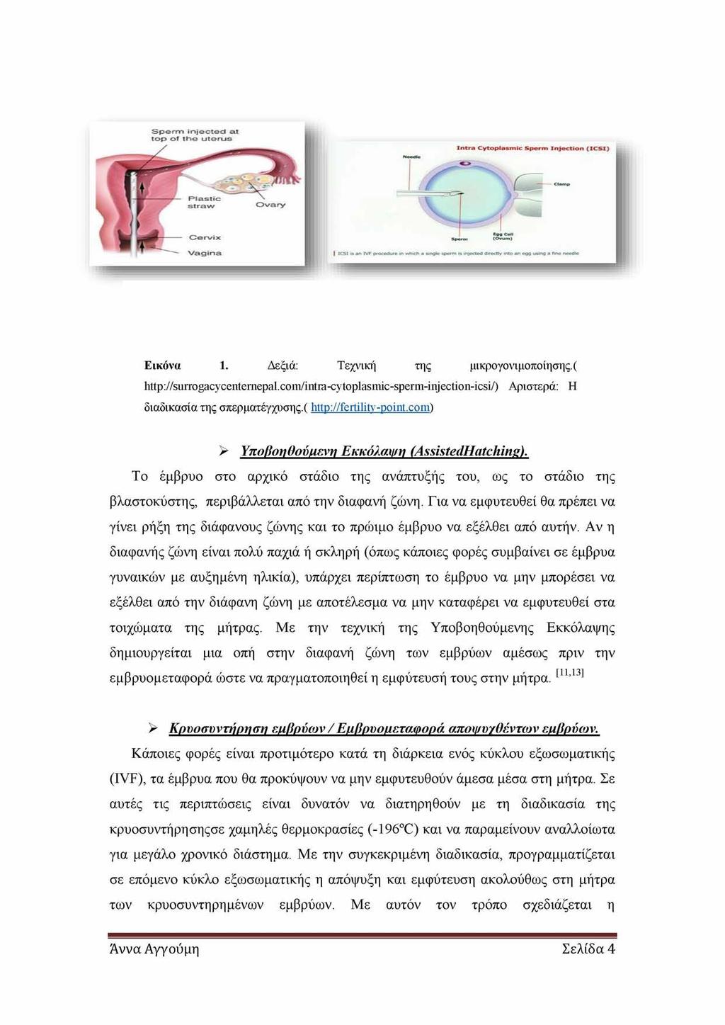 Εικόνα 1. Δεξιά: Τεχνική της μικρογονιμοποίησης.( http ://surrogacycentemepal. com/intra-cytoplasmic-sperm-inj ection-icsi/) Αριστερά: Η διαδικασία της σπερματέγχυσης.( http://fertility-point.