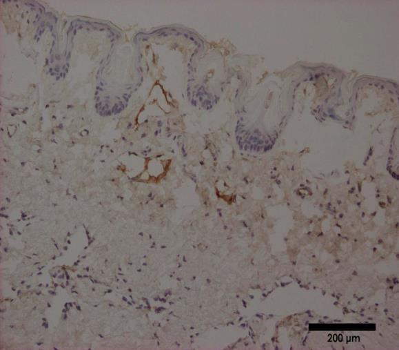 VEGF (IHC) ΚΕΦΑΛΑΙΟ 6: Μελέτη της επίδρασης της LI-ESWT σε γερασμένο στυτικό ιστό 211 Επιπλέον, τα παραπάνω αποτελέσματα επιβεβαιώθηκαν και από την ανοσοϊστοχημική ανάλυση, η οποία έδειξε επίσης