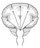 n Τονικοκλονικές (Tonic clonic) κρίσεις [ήταν γνωστές ως grand mal (μείζον επιληψία)] Οι τονικοκλονικές κρίσεις είναι γενικευμένες κρίσεις που σχετίζονται με ολόκληρο τον εγκέφαλο.
