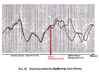72 ανοικτή εκδήλωση είναι και γίγνεσθαι 06.11.1999 και ιδεαλιστέ.