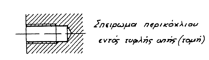 στα 3/4 του κύκλου.