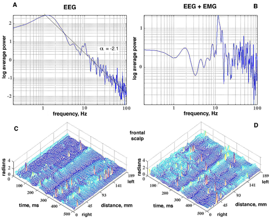 Global episodic beta/gamma synchrony 21 Freeman & Rogers Φιγ. 14.