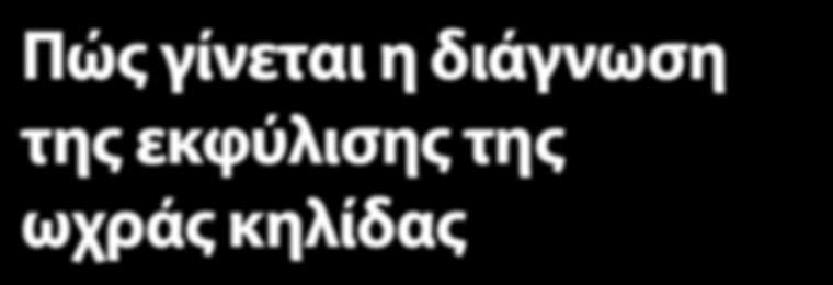 TM ΕΝΗΜΕΡΩΤΙΚΟ ΔΕΛΤΙΟ Διάγνωση μέσω οφθαλμολογικής εξέτασης Η διάγνωση της εκφύλισης της ωχράς κηλίδας μπορεί να γίνει μόνο μέσω εξέτασης του αμφιβληστροειδούς.