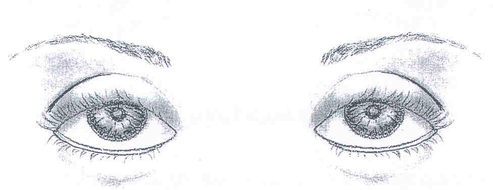 Εξόφθαλμα μάτια Σ αυτή την κατηγορία ανήκουν τα μάτια που προεξέχουν από την οφθαλμική κόγχη.