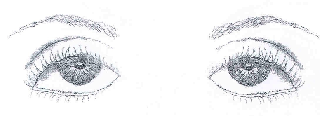 Καθοδικά μάτια Ο χαρακτηρισμός αυτός δίνεται σε σχέση με τη νοητή οριζόντια γραμμή, που ενώνει τις δύο εσωτερικές γωνίες των ματιών.