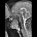 Απεικόνιση δυναμικών MRI: 3 πλαίσια από μία