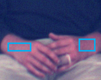 3(γ), για παράδειγμα όταν ένα δάκτυλο από το ένα χέρι αγγίζει ή ϐρίσκεται οριακά μπροστά από το άλλο χέρι ή το κεφάλι.