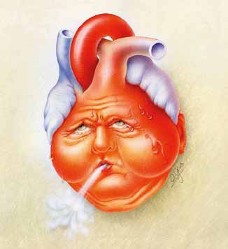 Εταιρείας Αρρυθμιών Καρδιακή ανεπάρκεια ορίζεται η κατάσταση όπου ο καρδιακός μυς και συνολικά η καρδιακή λειτουργία δεν μπορεί να εξυπηρετήσει τις ανάγκες σε αιμάτωση και οξυγόνωση του σώματος σε