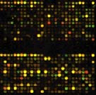 Δημοσίευση 1 Οι μικροσυστοιχίες ανιχνεύουν γονιδιακούς διακόπτες κατά το φυσιολογικό κυτταρικό κύκλο Μια ιστορία από το σακχαρομύκητα De Risi et al.