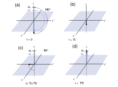 διάστημα TR μεταξύ των επαναλήψεων τουλάχιστον πενταπλάσιο του Τ 1, ώστε να επιτευχθεί η αρχική κατάσταση ισορροπίας.