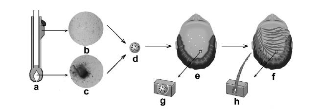 Treatment of alopecia by transplantation of hair follicle stem cells