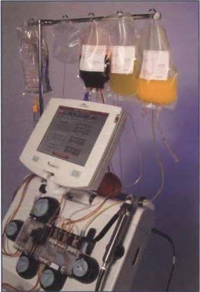 Αιμοπετάλια Αφαίρεσης Συλλογή με αυτόματο μηχάνημα κυτταροαφαίρεσης από ένα δότη αρκετών αιμοπεταλίων για 1-3 Θεραπευτικές Δόσεις μετάγγισης ενώ απαιτούνται pool 4-5 μονάδων ΑΜΠ