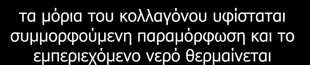 η διαδικασία της φωτοαφαίρεσης η δέσμη του laser «κτυπά» τον ιστό τα μόρια του κολλαγόνου υφίσταται συμμορφούμενη παραμόρφωση και