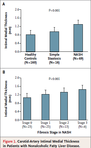Υποκλινική αθηροσκλήρωση (I) Μελέτη σε 85 ασθενείς με μη αλκοολική λιπώδη νόσο του ήπατος