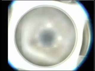 FS Laser