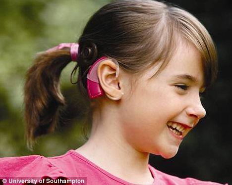 Κοχλιακά (Cochlear) Εμφυτεύματα Ποια είναι μερικά πιθανά οφέλη; Καλύτερη κατανόηση της ομιλίας (σε σύγκριση με ένα βοήθημα ακοής) Ευαισθητοποίηση και