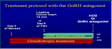 Πρωτόκολλα GnRH ανταγωνιστών Πρωτόκολλα GnRH ανταγωνιστών Πρωτόκολλο πολλαπλών δόσεων Πρωτόκολλο µίας δόσης Η χορήγηση γοναδοτροπινών ξεκινά την 2 η ηµέρα του κύκλου και ακολουθεί η χρήση των