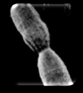 Propionibacterium Acnes Gram+ Αναερόβιος Μη σπορογόνος Λιπόφιλος βάκιλος (ραβδοειδές σχήμα) Ανήκει στο γένος των προπιονιβακτηρίων παλαιότερα corynobacteria (Κορυνόμορφα) Διακρίνουμε 3 είδη