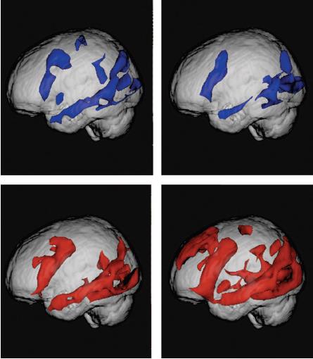 υλλογή Πληροφοριών Μελέτη με functional (MRI) για το πώς ανταποκρίνεται ο εγκέφαλος σε 24 άτομα 55 76 ετών όταν χρησιμοποιούν το internet υγκριτικά με την ανάγνωση κειμένου, η αναζήτηση στο internet