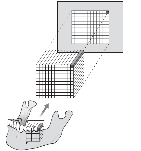 ακτίνων Χ στο σύνολο του κάθε voxel [2]. Αυτός ο δισδιάστατος περιορισμός έχει ξεπεραστεί με την ανάπτυξη της υπολογιστικής ή αξονικής τομογραφίας (computer tomography - CT). Εικόνα 2.
