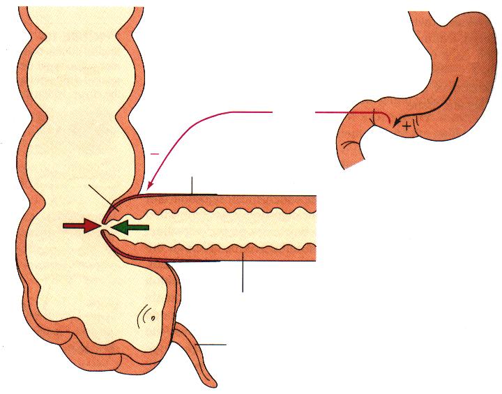 Έλεγχος της ειλεοκολικής βαλβίδας/σφιγκτήρα Ο σύνδεσμος μεταξύ του ειλεού και του παχέος εντέρου αποτελείται από την ειλεοκολική βαλβίδα, που περικυκλώνεται από ένα χονδρό λείο μυ, τον ειλεοκολικό
