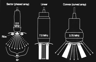 Doppler Δυναμική μελέτη με