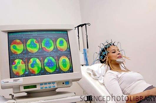 Παραδείγματα κυμάτων ΗΕΓ 1 δευτερολέπτου ε ύπνο Delta waves (0.