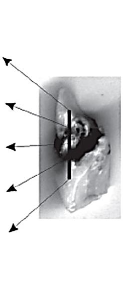 Εικόνα 1.6: Χωρική κατανομή του λόγου των συγκεντρώσεων μαγνησίου (Mg) προς ασβεστίου (Ca) ενός δοντιού με τερηδόνα. Η αυξημένη συγκέντρωση Mg υποδεικνύει την μολυσμένη περιοχή [27].