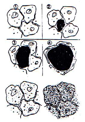 Απεικόνιση της αναπτύξεως παγοκρυστάλλων σε ιστό. Άνω σειρά (1-4): βραδεία κατάψυξη. Κάτω σειρά: ταχεία κατάψυξη. V.