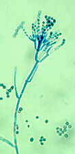 Ταξινόμηση μυκήτων ιατρικής σημασίας Μυκηλιακοί μύκητες Ασκομύκητες Αληθείς υφές με εγκάρσια διαφράγματα Ασκοσπόριο Κονίδιο