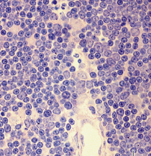 Κύτταρα του Θύμου Στρωματικά κύτταρα : υποκαψικά επιθηλιοκύτταρα, φλοιώδη επιθηλιοκύτταρα,