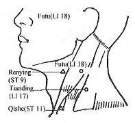 1) παχύ Εντερο Large Intestine Meridian- (20 σημεία) LI-1:ενδείξεις: Πονόλαιμος, πονόδοντο,coma που προκαλείται από εμπύρετη νόσο Μούδιασμα στην άκρη του δείκτη-κώφωσηοφελεία στο λαιμό.