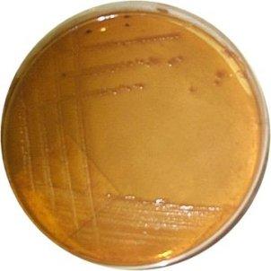 Blood agar MacConkey