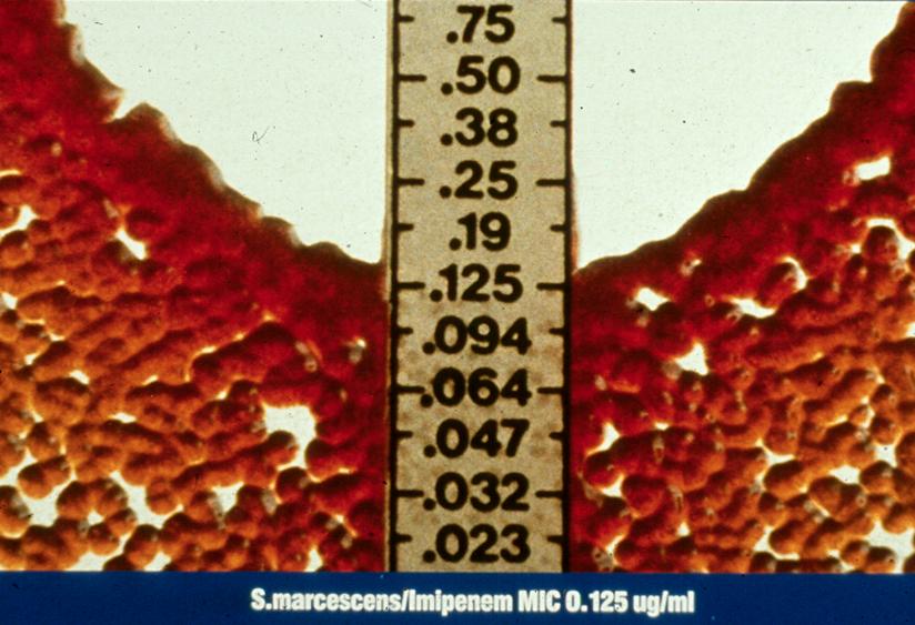 Μέθοδος κλιμακωτής (gradient) διάχυσης Πρώτη παρουσίαση: 1988 στο Interscience Conference on Antimicrobial