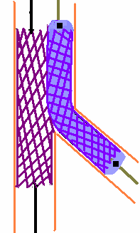 ΣΧΗΜΑΤΙΚΗ ΠΑΡΟΥΣΙΑΣΗ ΤΗΣ ΤΕΧΝΙΚΗΣ SKS (SIMULTANEOUS KISSING STENTING) A B C D A.